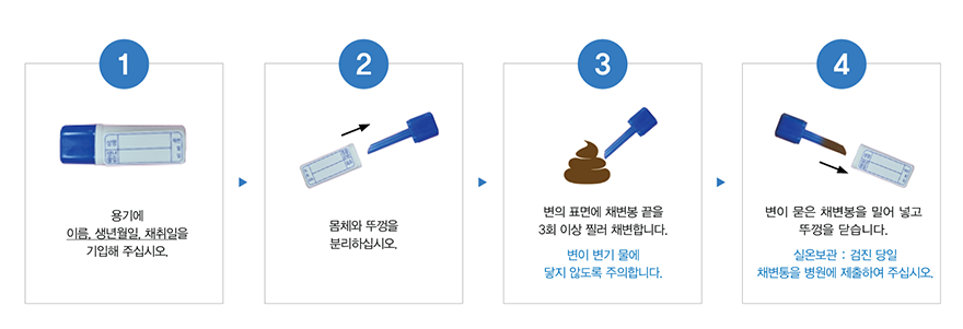 1.용기에 이름, 생년월일, 채취일을 기입해 주십시오. 2. 몸체와 뚜껑을 분리하십시오. 3.변의표면에 채변봉 끝을 3회 이상 찔러 채변합니다.(변이 변기물에 닿지않도록 주의합니다. 4.변이 묻은 채변봉을 밀어넣고 뚜껄을 닫습니다.(실온보관 : 검진당일 채변통을 변원에 제출하여 주십시오)